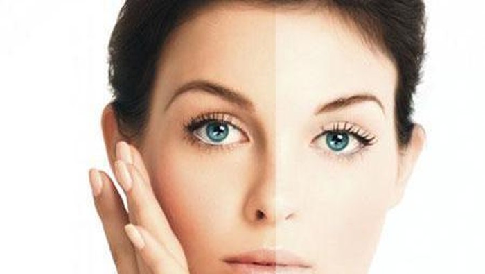 Memutihkan Kulit dengan Bleaching, Amankah?