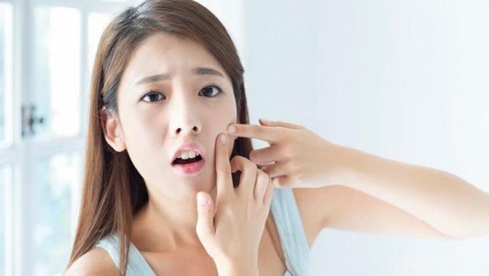 Ini Dia 5 Penyebab Timbulnya Jerawat Batu yang Perlu Kamu Tahu!