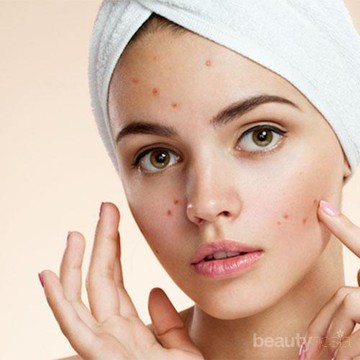 Ini Dia 5 Produk Penghilang Flek Hitam yang Ampuh Banget untuk Kulit Kamu!