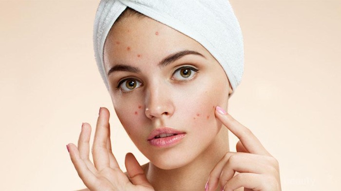 Ini Dia 5 Produk Penghilang Flek Hitam yang Ampuh Banget untuk Kulit Kamu! Ini Dia 5 Produk Penghilang Flek Hitam yang Ampuh Banget untuk Kulit Kamu!