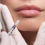 Inilah 5 Fakta yang Mungkin Belum Kamu Ketahui Tentang Lip Filler