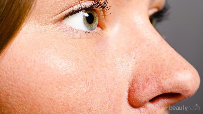 Wajib Tahu! Ini Penyebab Pori Wajah Membesar dan Cara Ampuh Mengatasinya!