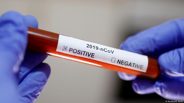 Wabah corona masih terus meluas, semakin banyak warga yang terkena virus ini. Jumlah kasus positif corona hari ini pun mencapai 4.241.