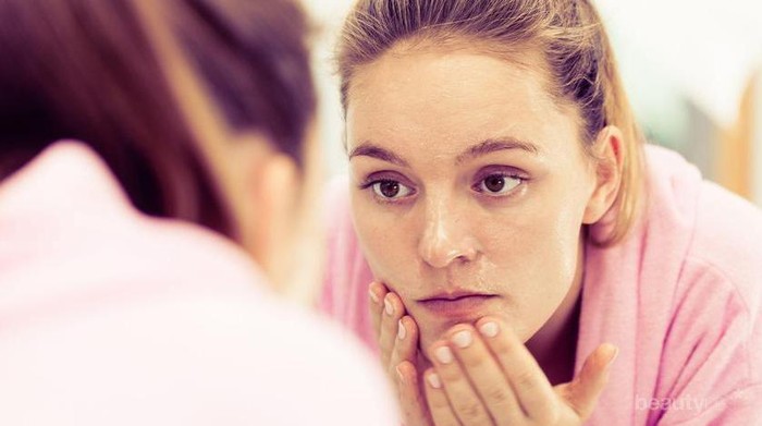 Coba Trik Sederhana Ini untuk Menghilangkan Komedo Secara Permanen!