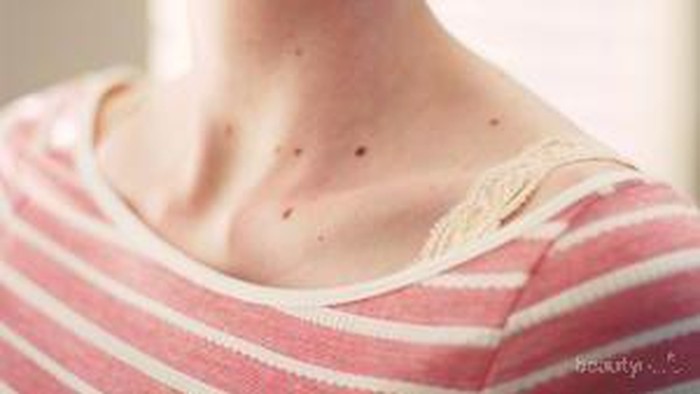 Letak Tahi Lalat Tunjukkan Kepribadian Kamu, Lho! Ini Penjelasannya