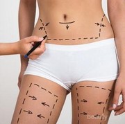 Ternyata Lemak Bisa Ditransfer! Ini Dia 4 Beauty Surgery yang Populer di Kalangan Wanita!