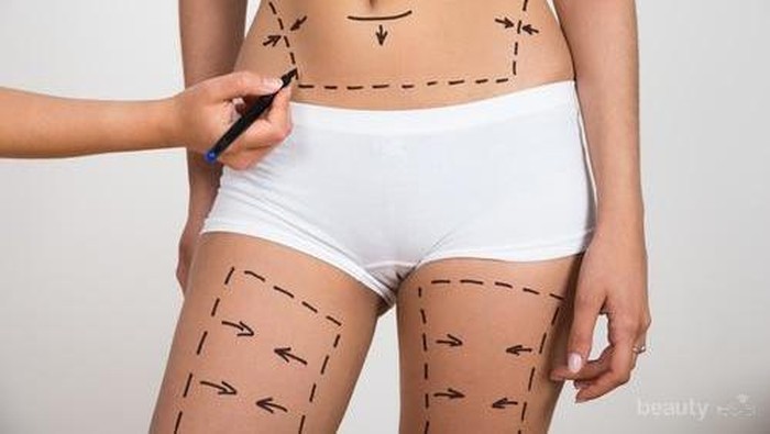 Ternyata Lemak Bisa Ditransfer! Ini Dia 4 Beauty Surgery yang Populer di Kalangan Wanita!