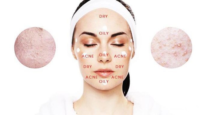 Punya Kulit Kombinasi? Begini Cara yang Paling Tepat untuk Mengatasinya!