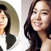 6 Artis Wanita Korea Ini Akui Menjalani Operasi Plastik Lho!