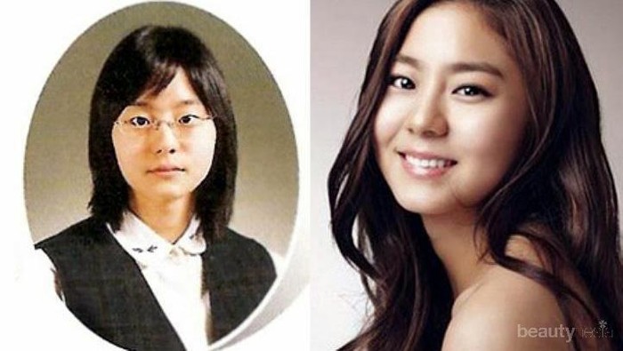 6 Artis Wanita Korea Ini Akui Menjalani Operasi Plastik Lho!