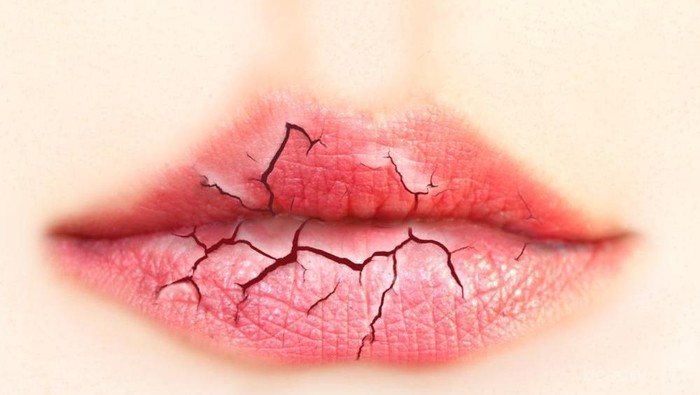 5 Tips Mengatasi Bibir Kering Saat Puasa yang Mudah dan Jitu 5 Tips Mengatasi Bibir Kering Saat Puasa yang Mudah dan Jitu