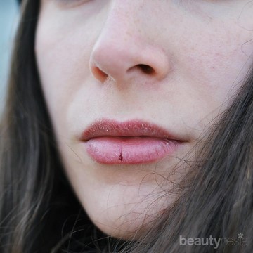 Tampil Lebih Menawan, Ini 5 Bahan Alami yang Efektif Rawat Bibir Kering