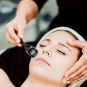 Microneedling, Perawatan Wajah yang Bisa Buat Wajahmu Cerah dan Awet Muda