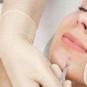 Serba-serbi Dermaplaning yang Wajib Kamu Ketahui!