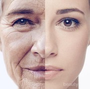 Bikin Awet Muda Secara Instan, Ini Serba-Serbi Frotox yang Perlu Kamu Tahu