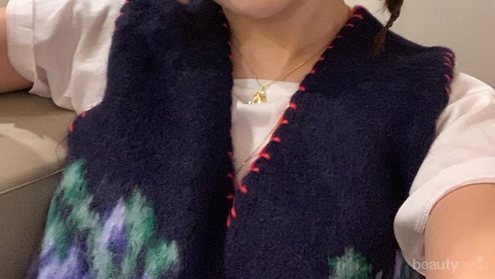 Lengan Seulgi Red Velvet yang Bikin Khawatir Fans, Kenapa?