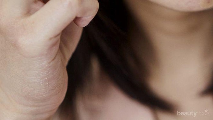 Serba-Serbi Sticker Jerawat, Benar Ampuh Hilangkan Jerawat Gak Sih?