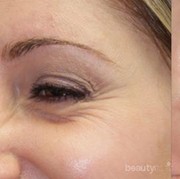 5 Langkah Hilangkan Kerutan di Wajah, Caranya Gampang!