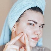 Enggak Melulu Pakai Skincare, Kamu Bisa Atasi Jerawat dengan Cara Ini!