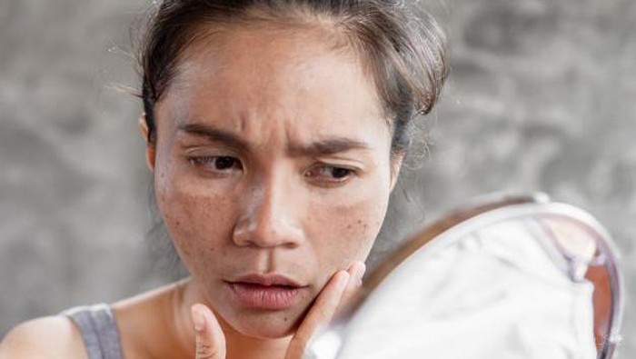 Wajib Tahu! Inilah 5 Cara Alami Mengecilkan Pori-Pori