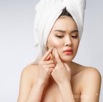 img-title Bahan-Bahan Alami Ampuh Hilangkan Bekas Jerawat dalam Hitungan Minggu