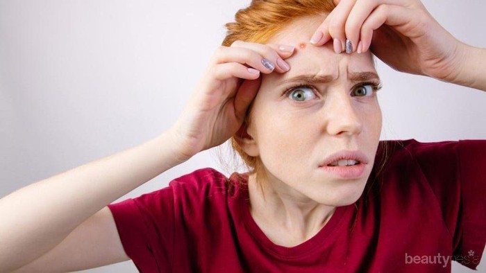 Skincare Routine Ini Cocok Buat Bikin Jerawat Cepat Hilang, Cobain Deh!