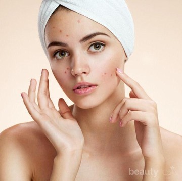 img-title Yuk, Rutin Lakukan 5 Tips Ini untuk Dapatkan Kulit Sehat dan Bebas Jerawat!