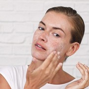 6 Hal Penyebab Kulit Wajah Rusak saat Eksfoliasi