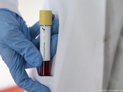 Perusahaan Ini Ciptakan Antibodi Penangkal Corona dari Plasma Darah Sapi