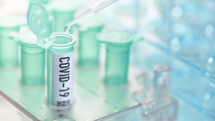 Jumlah pasien positif virus Corona di Indonesia bertambah lagi. Berikut data terbaru kasus COVID-19 yang telah dikonfirmasi pemerintah per 23 Maret 2020.
