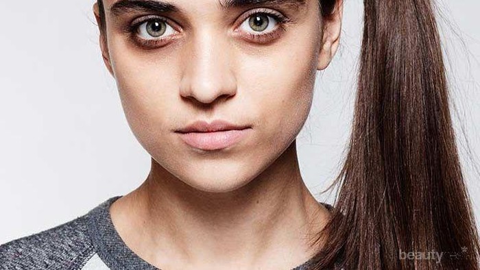 Terganggu Akibat Munculnya Mata Panda? Atasi dengan 7 Langkah Mudah Ini, Yuk!