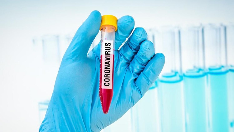 Hand of scientist is holding a test-tube with positive blood test on CORONAVIRUS