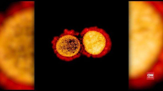 Video Gambar Terbaru Virus Corona Dirilis Video Gambar Terbaru Virus Corona Dirilis