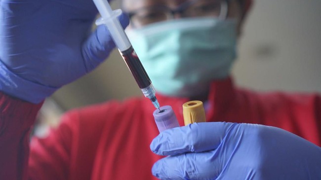 Pemerintah Inggris telah mengembangkan tes deteksi virus corona covid-19 massal murah, termasuk alat pengambil sampel swab.