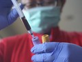 Jatim Gelar 2.020 Rapid Test, 49 Orang Positif Corona