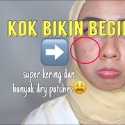 Alasan Kulit Enggak Cocok dengan Produk The Ordinary