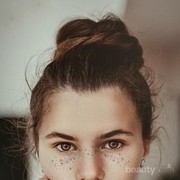 Ini Bedanya Freckles dan Flek Hitam, Cari Tahu Yuk!