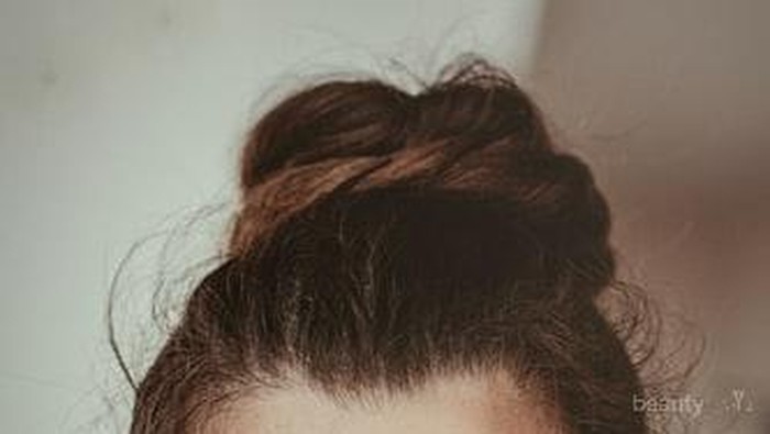 Ini Bedanya Freckles dan Flek Hitam, Cari Tahu Yuk!