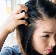 Tanpa Repot, Ini Cara Termudah Atasi Ketombe yang Bisa Kamu Coba!