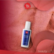 Review: Viva Acne Lotion Ampuh untuk Jerawat, Harganya Murah Meriah!