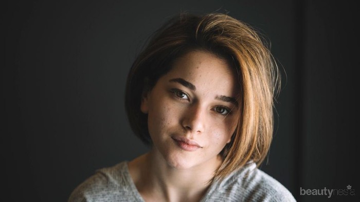 Jangan Sembarangan! 5 Kandungan Skincare Ini Bisa Memperparah Jerawat