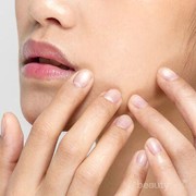 5 Tips Biar Kebiasaan Pakai Acne Patch Gak Sia-Sia