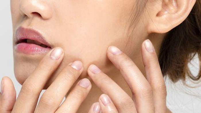 5 Tips Biar Kebiasaan Pakai Acne Patch Gak Sia-Sia