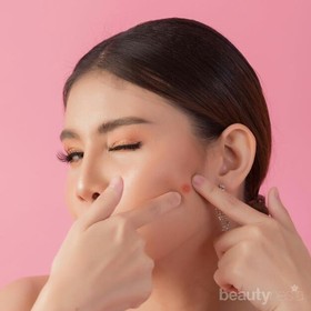 Tips Merawat Wajah Berjerawat Biar Gak Ninggalin Bekas!