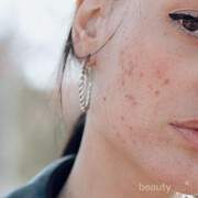 Wajah Berjerawat? Coba Deh Pakai Sabun Muka Ini!