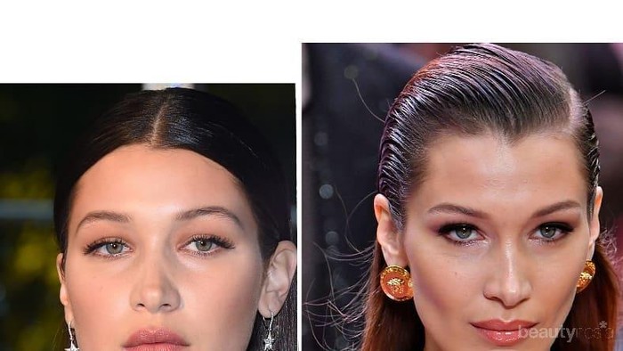 Menguak Fakta Operasi Pengangkatan Dahi, Kamu Mau Coba?