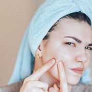 Jangan Sembarang! Jerawat di Bagian Wajah Ini Bahaya Kalau Dipencet