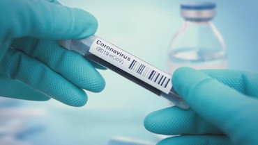 Diaspora Indonesia Meninggal di New York akibat Virus Corona