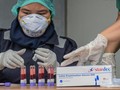 Rapid Test Covid-19, Dokter hingga Ahli Kompak Usulkan PCR