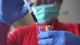 Obati Corona, RSCM-FKUI Cari Donor Plasma Darah Penyintas